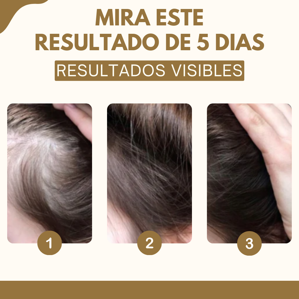 CREMA DE JENGIBRE™️  - Di adiós a la caída del pelo en pocos días